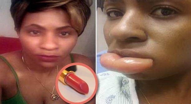 A folosit un ruj care se găsește &icirc;n toate supermarketurile! Ce a pățit această femeie a revoltat pe toată lumea