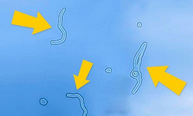 WOW! De ce vezi uneori stele verzi? Nu r&acirc;de, e o treabă c&acirc;t se poate de serioasă! La explicaţia asta nu te aşteptai