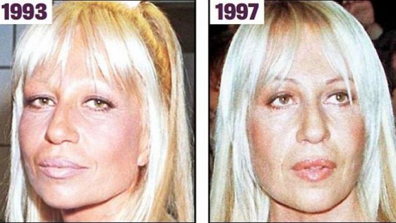 WOW! Frumusețe răpită de bisturiu! Cum arăta celebra Donatella Versace în tinerețe, înainte de operațiile estetice care au desfigurat-o