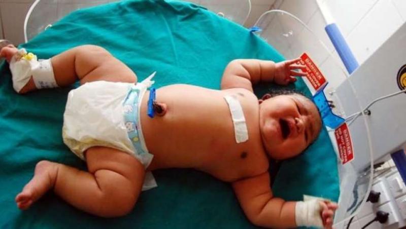 La naştere, un nou-născut din India are greutatea unui copil de șase luni. Medicul: 