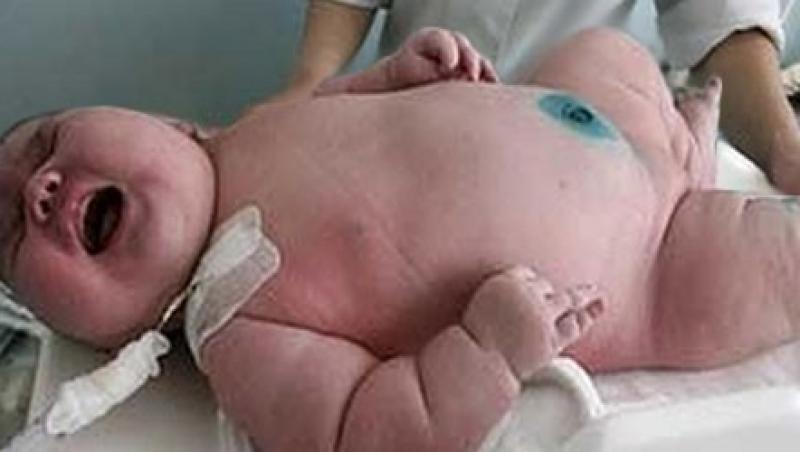 La naştere, un nou-născut din India are greutatea unui copil de șase luni. Medicul: 
