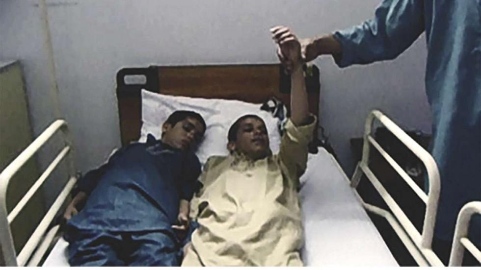 Doi fraţi au şocat lumea medicală! Cad inconştienţi pe stradă, o dată cu dispariţia soarelui