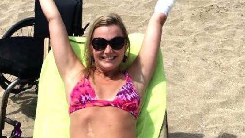 Fără ambele mâini şi un picior, Aimee Copeland duce o viaţă exemplară. Pozează pe plajă fără niciun complex