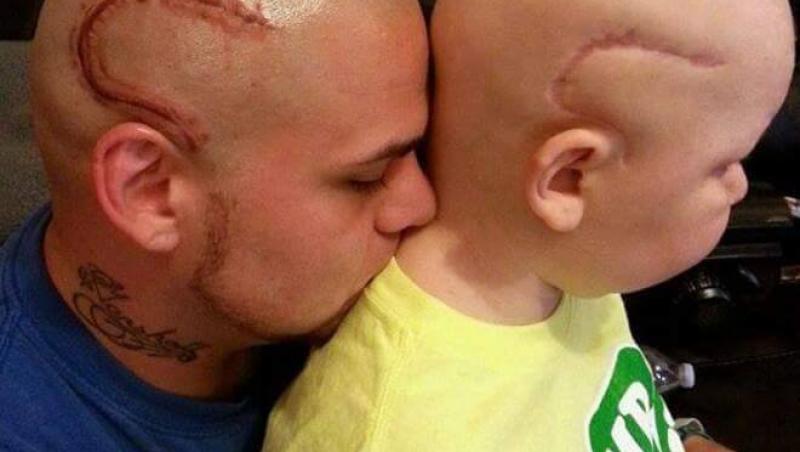 Poveste Emoționantă: Un tată și-a tatuat cicatricea fiului său lăsată de cancer. Gestul a emoționat sute și sute de oameni
