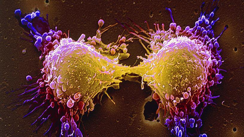 Cercetătorii lucrează la un vaccin care ne-ar face imuni la toate tipurile de cancer