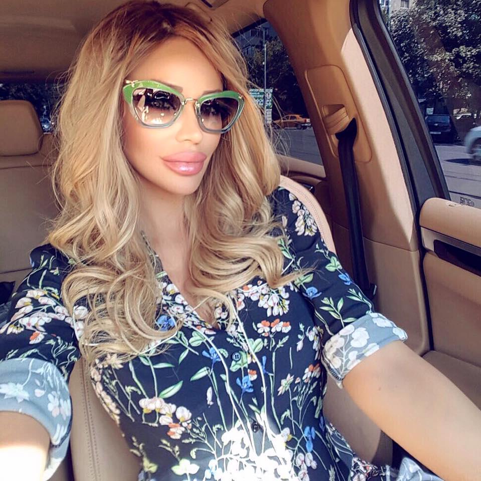 &Icirc;nsărcinată &icirc;n șase luni, Bianca Drăgușanu este implicată &icirc;ntr-un scandal "estetic": "Una dintre pacientele doctorului s-a trezit cu buza căzută!"