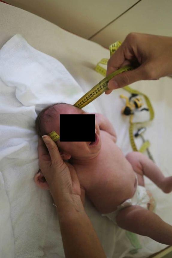 Apar primele probleme! O femeie infectată cu Zika a dat naştere, &icirc;n Spania, unui bebeluş cu microcefalie provocată de acest virus &icirc;n Europa