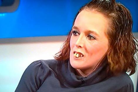 Gemma Swift, femeia cu cei mai urâți dinți din lume, și-a „reparat” dantura!