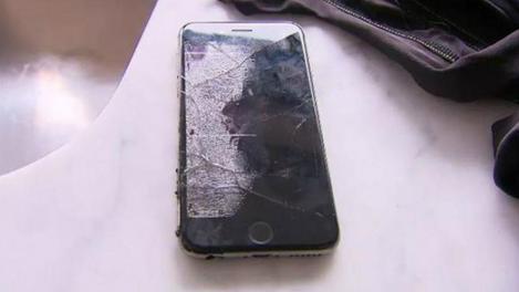 Un iPhone explodat i-a provocat arsuri de gradul trei: Imaginile cu bărbatul rănit fac înconjurul internetului