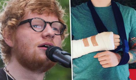 Veste tristă pentru fanii lui Ed Sheeran! Artistul și-a anulat concertele, după ce a fost implicat într-un accident de bicicletă