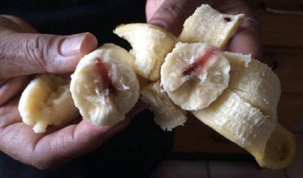 Părinți, fiți atenți la ce consumă copiii voștri! O fetiță a mușcat dintr-o banană și apoi a văzut niște linii roșii &icirc;n fruct. Femeia a dus-o de urgență la spital