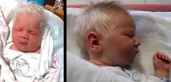 Un bebeluș s-a născut cu părul alb! C&acirc;nd doctorii au dezvăluit motivul, părinții au rămas fără glas!