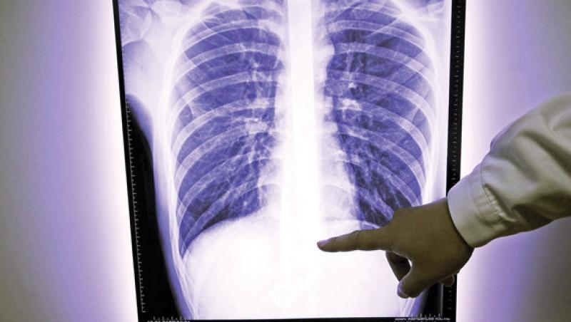 Un bărbat a înghiţit o sabie și a mers să-și facă radiografie pentru a demonstra că nu minte