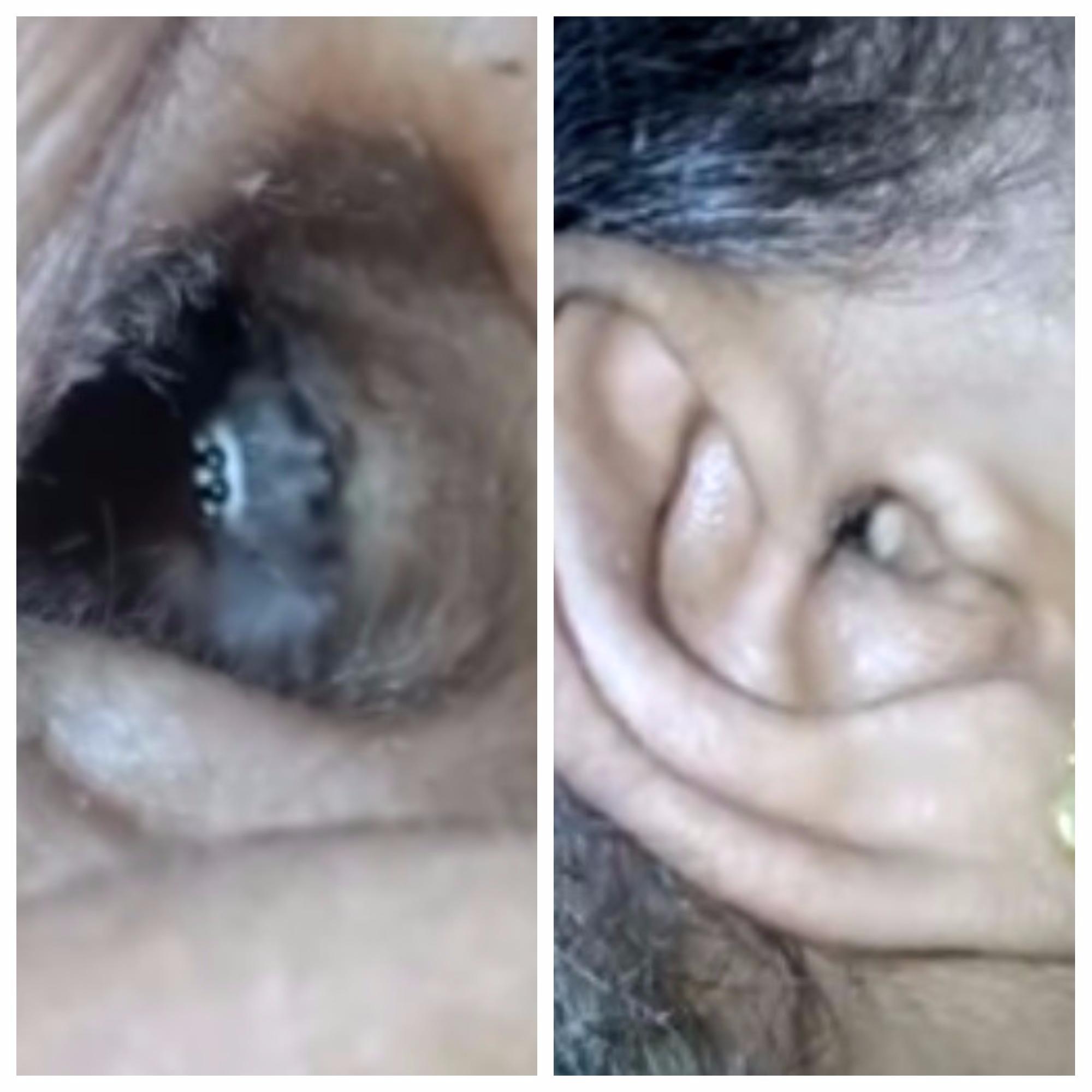 Avea dureri groaznice de cap! C&acirc;nd a ajuns la spital, medicii au rămas &icirc;ngroziți de ce au găsit &icirc;n urechea femeii