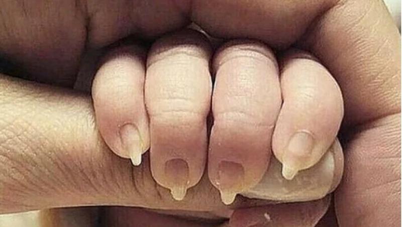 Viral. Imaginea care a pus pe jar mii de părinţi. Cum au fost fotografiate degetele acestui bebeluş: 