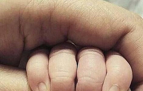 Viral. Imaginea care a pus pe jar mii de părinţi. Cum au fost fotografiate degetele acestui bebeluş: "Sterilizaţi-vă!"