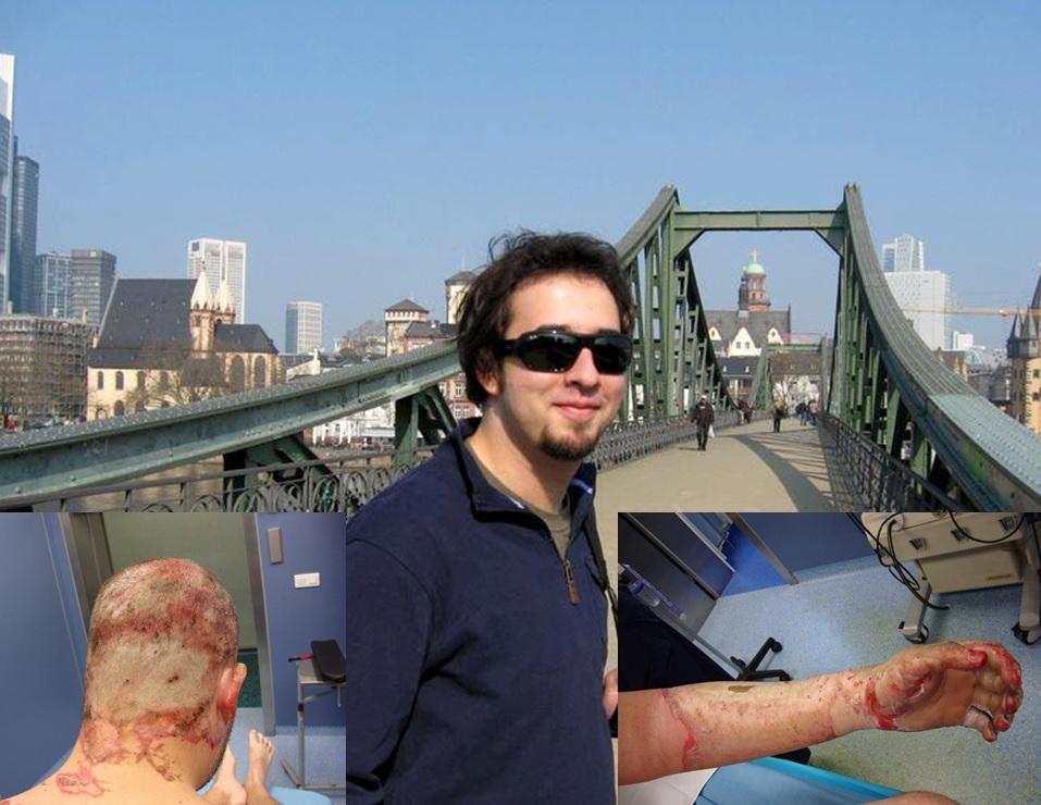 Doi ani de la Colectiv. După a șaptea operație, Liviu se recuperează: &rdquo;Am uitat cum arată casa mea. Și da, sunt pesimit, nimic nu se va schimba &icirc;n Rom&acirc;nia"