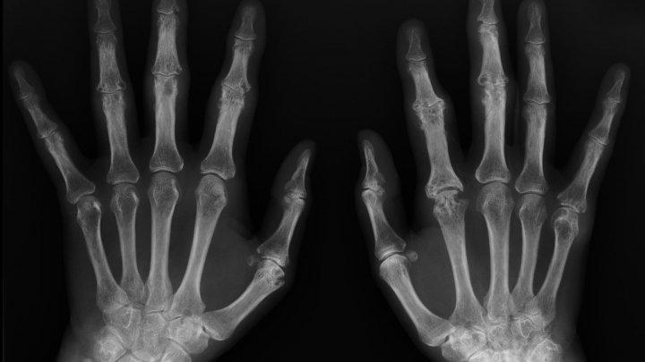 Un studiu alertează Planeta! Stai &icirc;n București sau &icirc;n alt oraș mare? E &Icirc;NFIORĂTOR ce se &icirc;nt&acirc;mplă cu oasele locuitorilor din orașele poluate