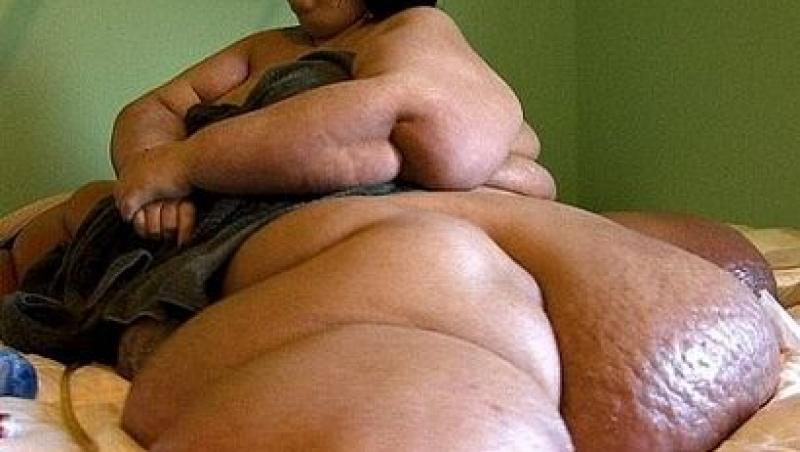 Această femeie a slăbit 362 de kilograme: „Acum mănânc ca să supraviețuiesc. Înainte trăiam ca să mănânc!”