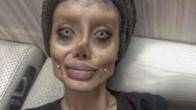 O femeie a făcut zeci de operații estetice pentru a semăna cu Angelina Jolie! Din păcate, rezultatul a fost dezastruos! A slăbit 80 de kilograme!