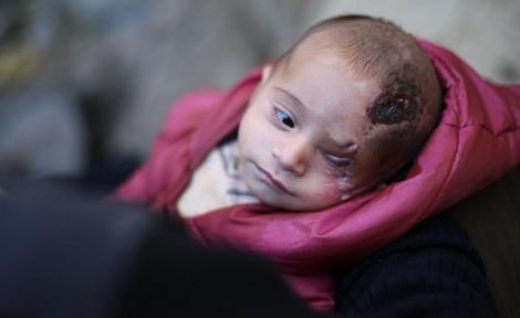 Un bebeluş sirian, care şi-a pierdut un ochi într-un bombardament al regimului, simbol pe Internet: "Imaginea lui m-a marcat înainte să-l fotografiez. Ea mă bântuia"