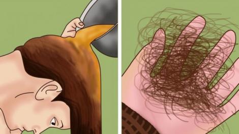 Oprește căderea părului în mod natural. Soluții simple și ușoare pentru un păr puternic.