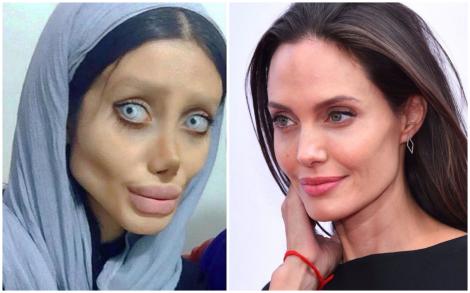 Imaginile şocante au făcut înconjurul lumii iar acum recunoaşte că a minţit. Cum arată, de fapt, tânăra din Iran care vrea să semene cu Angelina Jolie: "Nu am 50 de operaţii"