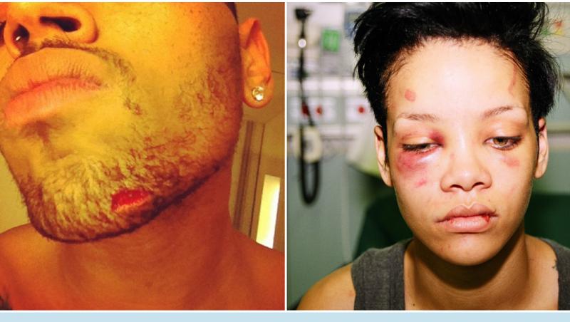 Chris Brown a lovit-o cu pumnul în stomac până și-a pierdut cunoștința! Fostul iubit al Rihannei, în scandal cu un top model