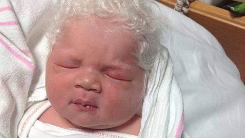 Foto! A născut un băieţel, însă doctorul ezita să i-l arate! Până şi medicul a rămas blocat de ce avea pe cap
