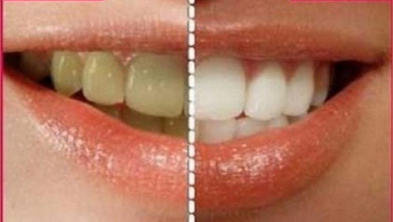 Rețeta bio care-ți albește dinții PE LOC face furori! Totul se prepară rapid și ieftin, iar eficiența e uluitoare!
