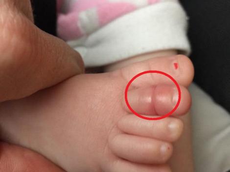 Dacă bebelușul tău plânge fără încetare și nu știi ce să îi faci, ar fi bine să îi verifici piciorușul. Poate fi în pericol!