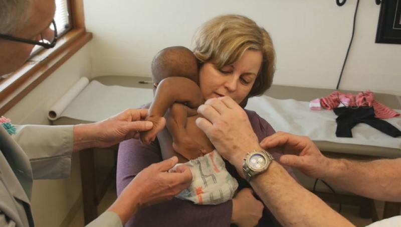 O fetiță care s-a născut cu patru picioare și două coloane vertebrale, operată de 50 de medici. Dominique va avea șansa la o viață normală