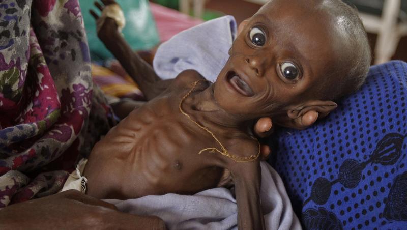 Peste 100 de persoane au murit de foame, în ultimele 48 de ore, în Somalia. Guvernul îi îndemnă pe somalezi să-i ajute pe cei aflaţi pe moarte