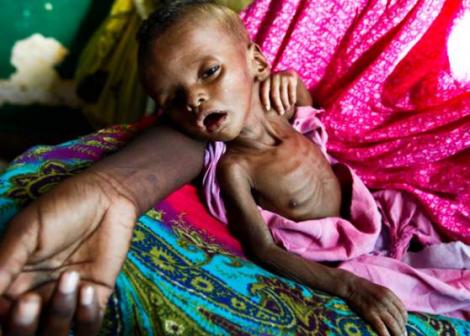 Peste 100 de persoane au murit de foame, în ultimele 48 de ore, în Somalia. Guvernul îi îndemnă pe somalezi să-i ajute pe cei aflaţi pe moarte