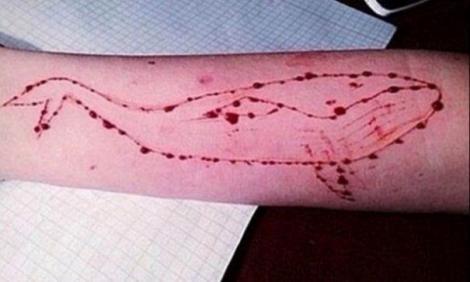 Balena Albastră” lovește la Focșani! Un copil s-a scrijelit pe picioare cu o lamă: Ce au văzut colegii pe corpul său