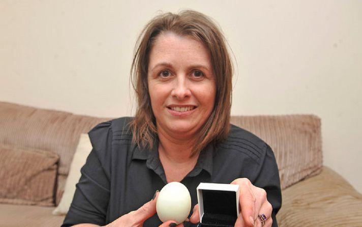 Foto! A fiert un OU pentru micul dejun, dar mare i-a fost mirarea c&acirc;nd a văzut ce se afla &icirc;n el. Descoperirea uimitoare făcută de femeie