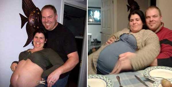 O femeie și-a mințit iubitul că este &icirc;nsărcinată și că va naște cinci bebeluși, dar medicii au constatat că e bolnavă de o boală rară