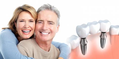 Tipuri de implanturi dentare si importanta pe care acestea o au