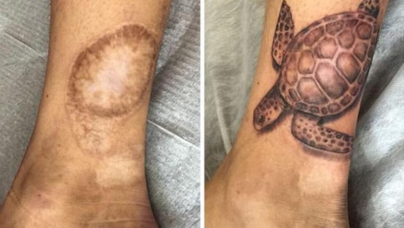 GALERIE FOTO. Urmele lăsate pe piele de un trecut dureros, ridicate la rang de artă! Cicatrici transformate în tatuaje: 18 imagini impresionate