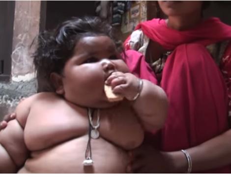 Video cutremurător! Are doar opt luni, dar cântăreşte cât un copil de patru ani. Imaginile cu fetiţa desfigurată fac înconjurul lumii