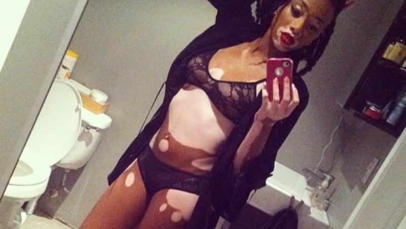 Winnie Harlow, modelul cu pielea în două culori. Cum arată acum