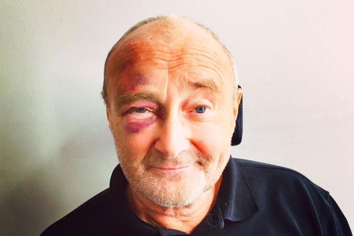 &rdquo;Another day in paradise", &icirc;n cea mai sinceră variantă! După ce s-a lovit la cap &icirc;ntr-o cameră de hotel, Phil Collins a revenit &icirc;n fața fanilor cu piciorul rupt, alături de fiul său de 16 ani