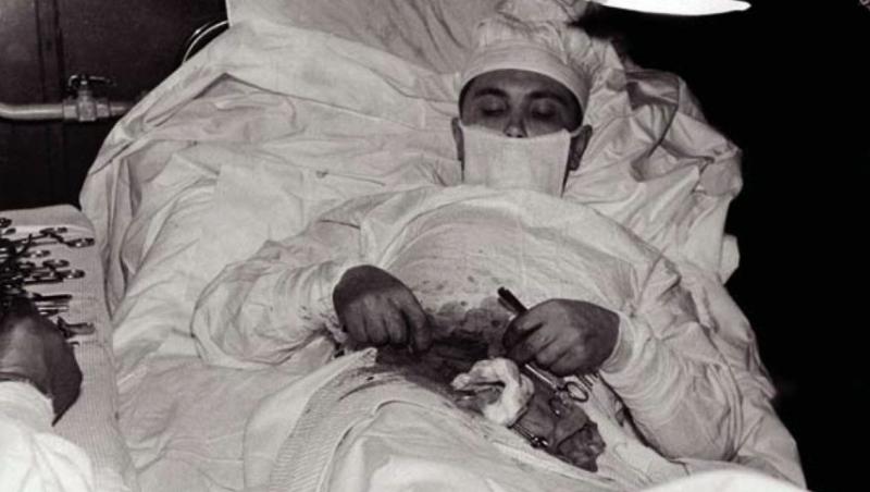 O poveste doar pentru CURAJOŞI! Leonid Rogozov, singurul chirurg care S-A OPERAT SINGUR: 