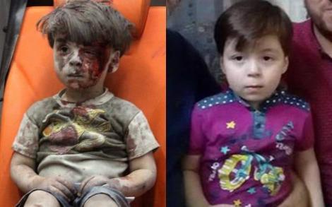 Uită-te bine! Da, este chiar "BĂIATUL DIN AMBULANŢĂ"! Omran Daqneesh, copilul simbol al tragediei din Siria, fotografiat după aproape un an: "Au vrut să promoveze vărsarea de sânge"