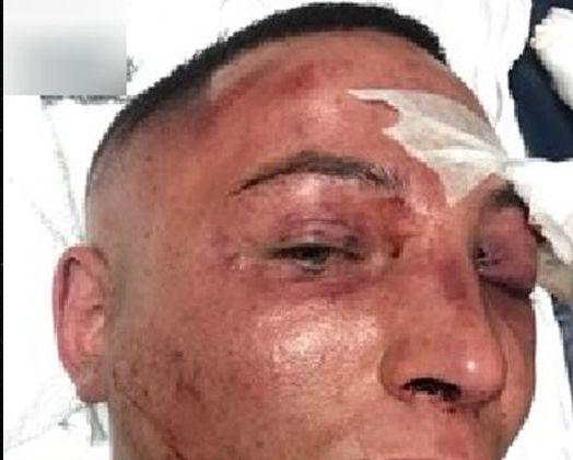 O cunoscută c&acirc;ntăreață implicată &icirc;ntr-un scandal monstruos. Prietenul său a fost BĂTUT cu bestialitate, iar ea arestată!