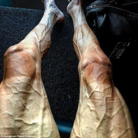 FOTO: Tu, leneșule corporatist, nici măcar nu știai că ai atâtea vene! Așa arată picioarele unui ciclist, după ce termină o cursă în Turul Franței