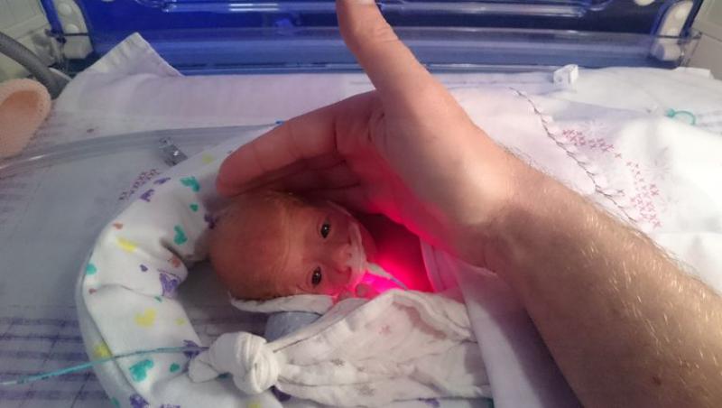 Miracol și iscusința unui doctor! Un bebeluș de 500 de grame, „mare cât palma mamei lui”, a fost salvat de un medic într-un mod ingenios