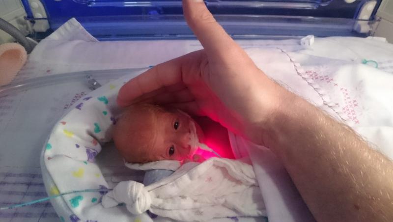 Miracol și iscusința unui doctor! Un bebeluș de 500 de grame, „mare cât palma mamei lui”, a fost salvat de un medic într-un mod ingenios