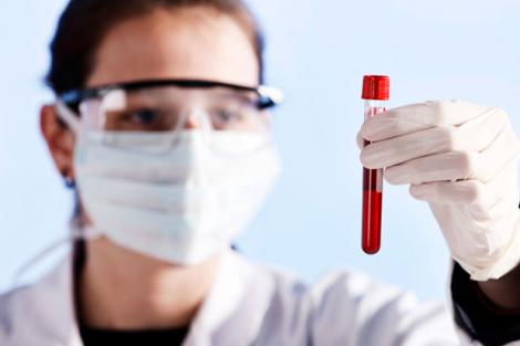 Testul de sânge care-ți spune dacă suferi de cancer ovarian. Este de două ori mai eficient decât analinezele actuale