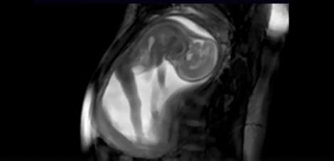 Cele mai tari imagini cu sarcina unei femei. Bebe se ridică în picioare, "centrează și dă cu capul". Sigur va fi sportiv! (VIDEO AMUZANT)
